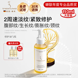 嫩芙橄榄油妊娠前备孕妇女预防护理期淡化纹路按摩肌肤专用护肤品礼物 【淡化纹路】精华油110ml