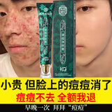 同仁堂祛痘膏去痘痘和痘印痘坑修复男女士改善粉刺闭口30g