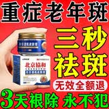 北京协和医学院祛斑霜老年斑专用特效非药一夜消去老年斑的药强力祛除手部脸部 特效3盒【平均1盒23】900%包消斑买2送1净膏去斑膏 美i白祛斑霜淡化黑色素去黄褐斑雀斑晒斑男女士专用的