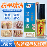 诺必衍脱甲液灰指甲专用液脱甲精油脱去甲液灰指甲清正品去除指甲