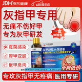 御菲清灰指甲药水指甲真菌感染脱甲增厚重度杀抑菌液正品甲沟炎搭亮贴膏