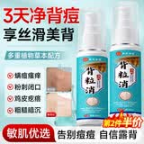北同世家祛痘喷雾背粒消前胸后背祛痘淡化痘印粉刺背粒美背神器祛痘膏