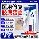 BKWILD医用重组生长因子凝胶胶原蛋白点痣喷人表皮祛疤痕膏修复生肌膏