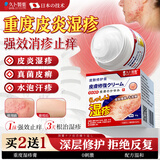 久卜制药湿疹药膏止痒抑菌皮肤瘙痒去根顽固湿毒皮炎汗疱真菌感染阴囊潮湿