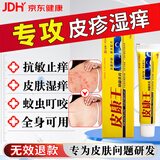 得贝俏皮康王皮i炎湿i疹癣皮真菌感染止痒膏老牌子官方正品皮肤抑菌舒缓