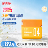 郁美净面霜控油祛痘精华霜50g改善痘后红印清爽不黏腻润肤乳成人适用