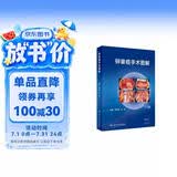 卵巢癌手术图解