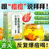 养庆堂金银花蒲公英菊花茶 护养生茶肝明金银花目滋补祛痘熬夜茶叶150g