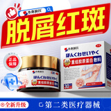 本桑制药牛皮癣专用膏真菌止痒抑菌皮肤顽固牛皮癣银屑病生物制剂鳞屑红斑