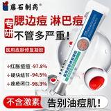藤石制药腮边痘硬块痘淋巴痘专用祛痘膏下巴硬块红肿搭药脖子脸颊两边Q3 一盒痤疮霜 送棉签【 淋巴腮边痤疮痘】