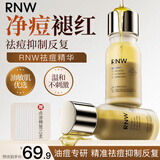 如薇（RNW）胶态硫控油高效祛痘粉精华液10ml油痘肌青少年青春痘男女男女