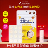 欧利芙洋痘痘贴韩国OliveYoungCareplus隐形痘痘贴青春痘贴轻薄遮痘印礼物 【夜用修护】蜂蜜款84片