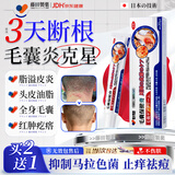 藤田制药毛囊炎头皮痒止痒脂溢性皮炎脓包长疙瘩马拉色菌后背长痘痘专用膏