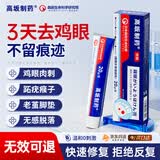 高坂制药鸡眼贴膏去肉刺刺猴药膏无痛脱落连根拔除跖疣专用去脚底老茧20g