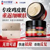 川廿制药鸡皮肤疙瘩毛囊角质化专用去除大腿胳膊手臂身体磨砂药膏嫩白全身