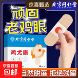 北京同仁堂鸡眼贴鸡眼膏鸡贴眼膏鸡茧膏去除老茧脚底手上肉刺瘊子 重度鸡眼【3盒装】共18贴