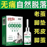 祥醫堂草本清茧净老茧去除软化剂鸡 眼手茧关节茧脚垫茧去茧膏神器