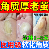 [信龙]水杨酸软膏 5%*20g 1盒装 去脚底老茧去硬皮老茧软化膏茧子去除去老茧去脚底老茧硬皮鸡眼膏去肉刺药膏无痛脱落 医用级药膏