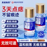 高坂制药点痣膏点斑祛疣水脸部去黑痣扁平跖疣搭修复液无痕不留疤非药5ml