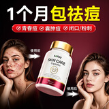 Selay【一个月包祛痘】进口祛痘顽固痘肌痘印囊肿闭口粉刺内分泌失调