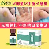 森卓清茧灵脚茧脚底老茧硬皮死皮厚茧脚垫茧子根软化膏非药非去除神器 2盒装【立减29元】
