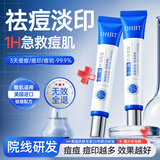 OHBT壬二酸15%凝胶水杨酸祛痘药膏祛痘淡化痘印坑消炎痤疮专用青少年