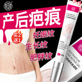 内廷上用祛疤膏妊娠纹剖腹产修复产后淡化疤痕增生修复凝胶