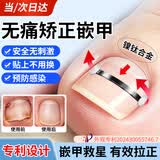 力仕康甲沟炎专用矫正神器甲沟炎专用指甲刀纠正嵌甲指甲长肉里矫正贴
