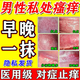 [扬子洲]硝酸咪康唑乳膏 2%*20g 2盒装 男士私处瘙痒药膏皮肤用药非处方药下体蛋皮睾丸阴囊潮湿瘙痒男人私处男科用止痒 硝酸咪康唑乳膏正品官方