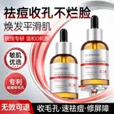 透真水杨酸果酸精华液收缩毛孔粗大修复控油祛痘淡化痘印痘坑壬二酸