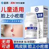韶琪儿童脸上小疙瘩用的鸡皮肤去除神器毛周角化专用可搭药膏脸部50g