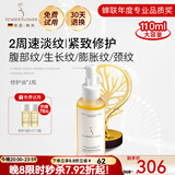 嫩芙橄榄油妊娠前备孕妇女预防护理期淡化纹路按摩肌肤专用护肤品礼物 【淡化纹路】精华油110ml