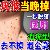 九春制药祛疣膏疣体脱落膏药扁平疣专用瘊子脖子上肉粒寻常瘊肉赘长小疙瘩 特效单盒装【一抹起效】 清优灵去尤疣子脱落医用神器手上