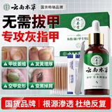 纯春堂云南本草灰指甲专用特殊效中草药抑菌液增厚发黄中空灰甲净护理盒