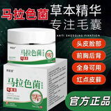祥醫堂马拉色菌毛囊膏祛痘除螨瘙痒可用正品草本萃取温和舒适