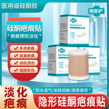常医护医用硅酮疤痕贴手术烧烫伤口去疤痕增生疙瘩遮盖凝胶修复淡化预防 一盒【试用装】轻度伤疤 5*50cm/1卷/盒