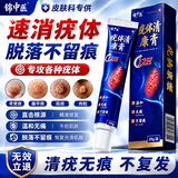 锦中医扁平疣专用祛去疣疣体脱落膏丝状疣瘊灵去除脖子小肉粒药膏