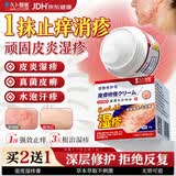 久卜制药湿疹药膏止痒抑菌皮肤瘙痒去根顽固湿毒皮炎汗疱真菌感染阴囊潮湿