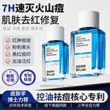 蓓安亲研小蓝瓶3.0 祛痘精华液30ml 刷酸祛痘控油水杨酸送礼送女友