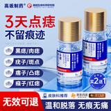 高坂制药点痣膏点斑祛疣药水脸部去黑痣扁平跖疣修复液无痕不留疤非药5ml
