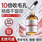 透真水杨酸果酸精华液收缩毛孔粗大修复控油祛痘淡化痘印痘坑壬二酸