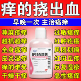 [瑞林]炉甘石洗剂 100ml 1盒装 皮肤止痒特药正品效炉甘石洗剂皮肤瘙痒皮炎湿疹真菌感染荨麻疹成人婴儿炉甘石涂剂抑菌 皮肤止痒特用药抑菌止痒