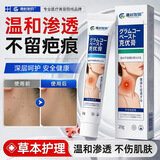 港村制药疣扁平去除软膏疣瘊肉粒一抹灵无忧小肉粒疣丝状专用神器ss 1支基础装【贵在运费】