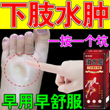 百约王水肿消肿浮肿下肢水肿药消除利脸肿四肢肿老人脚肿全身浮肿去肿湿 买二送一【疗程装】