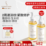 嫩芙橄榄油妊娠前备孕妇女预防护理期淡化纹路按摩专用护肤品七夕礼物 【店长推荐&立省78】精华油110ml*2瓶