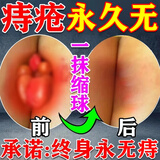 南京同仁堂痔疮膏痔疮凝胶专用去肉球断根专用特强效药痔根断去肉球消肿进口 100%特效:3盒【肉球便血疗程装】 痔疮膏去肉球内外混合痔疮专用膏药槐实膏