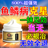 诸葛太医鱼鳞皮肤专用膏药去鱼鳞病蛇皮鸡皮肤霜全身腿部干燥脱屑身体乳 特效1盒【鱼鳞病克星】 鱼鳞皮肤霜去腿上鱼鳞皮