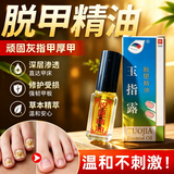 祥醫堂脱甲液灰指甲专用液足部护理脱甲精油液灰指甲清正品去除指甲抑菌