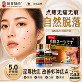 川廿制药去痣点痣膏无痕点斑点疣药水脸部不留疤美容院专用祛黑痣肉痣