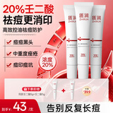 质润壬二酸凝胶20%壬二酸乳膏祛痘印修复淡化痘印非医用祛痘膏45g